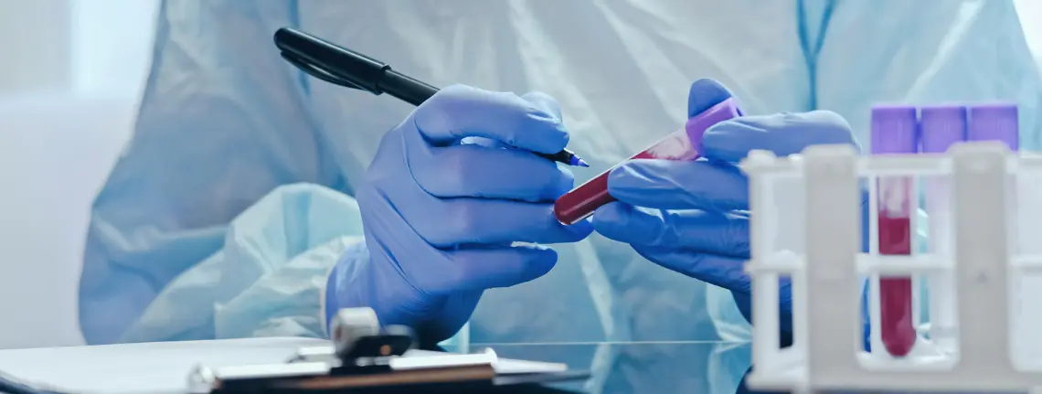 Lean Transformation in azienda di diagnostica di laboratorio – consulenza Lenovys